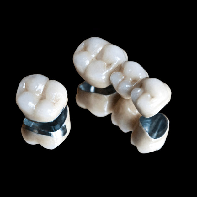 PFM (Porcelain Fused to Metal)